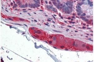 Human Small Intestine, submucosal plexus: Formalin-Fixed, Paraffin-Embedded (FFPE) (TUBB2A antibody  (AA 1-446))