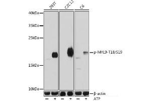 Western blot analysis of extracts of various cell lines using Phospho-MYL9(T18/S19) Polyclonal Antibody at dilution of 1:1000. (MYL9 antibody  (pSer19, pThr18))