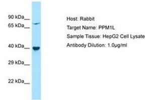 Image no. 1 for anti-Protein Phosphatase, Mg2+/Mn2+ Dependent, 1L (PPM1L) (AA 141-190) antibody (ABIN6750224)