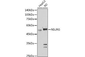 Western blot analysis of extracts of various cell lines, using NSUN5 antibody (ABIN7268955) at 1:1000 dilution.