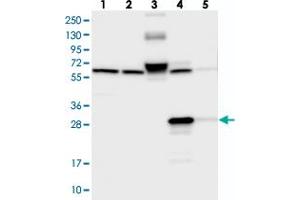 Western blot analysis of Lane 1: RT-4, Lane 2: U-251 MG, Lane 3: Human Plasma, Lane 4: Liver, Lane 5: Tonsil with ECHDC3 polyclonal antibody  at 1:250-1:500 dilution. (ECHDC3 antibody)