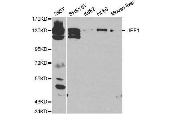 RENT1/UPF1 anticorps  (AA 270-370)