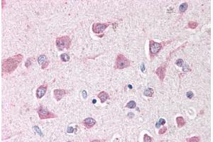 Human Brain, Cortex (formalin-fixed, paraffin-embedded) stained with ING3 antibody ABIN291938 at 2. (ING3 antibody  (AA 294-304))