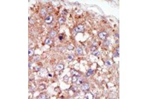 Image no. 2 for anti-PTK6 Protein tyrosine Kinase 6 (PTK6) (N-Term) antibody (ABIN359990) (PTK6 antibody  (N-Term))