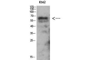 Western Blot (WB) analysis of K562 using Antibody diluted at 1:1000. (PRKAG2 antibody  (N-Term))
