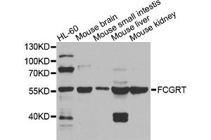 Western blot analysis of extracts of various cell lines, using FCGRT antibody. (FcRn antibody)