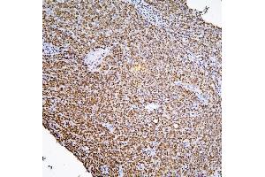 IHC analysis of PHF21A using anti-PHF21A antibody (ABIN6719353). (PHF21A antibody  (AA 1-97))