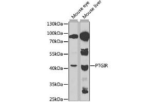 Western blot analysis of extracts of various cell lines, using PTGIR antibody. (Prostacyclin Receptor antibody)
