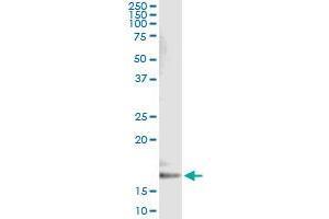 Western Blotting (WB) image for anti-Cytochrome B5 Type A (Microsomal) (CYB5A) (AA 1-134) antibody (ABIN514807)
