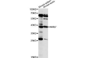 Western blot analysis of extracts of various cell lines, using NME7 antibody (ABIN6293928) at 1:1000 dilution. (NME7 antibody)
