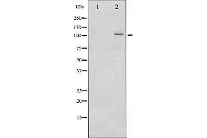 Western blot analysis of NF- kappaB p100/p52 phosphorylation expression in ovary cancer whole cell lysates,The lane on the left is treated with the antigen-specific peptide. (NFKB2 antibody  (pSer866))
