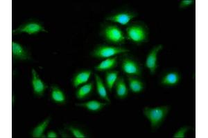 Immunofluorescence staining of A549 cells with ABIN7147387 at 1:100, counter-stained with DAPI. (CEP135 antibody  (AA 94-195))