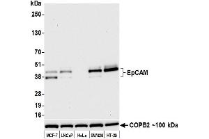 Western Blotting (WB) image for anti-Epithelial Cell Adhesion Molecule (EPCAM) (AA 24-265) antibody (ABIN7453970) (Recombinant EpCAM antibody  (AA 24-265))
