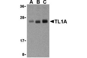 Western Blotting (WB) image for anti-Tumor Necrosis Factor (Ligand) Superfamily, Member 15 (TNFSF15) (N-Term) antibody (ABIN1031618) (TNFSF15 antibody  (N-Term))