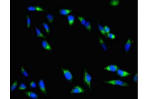 Immunofluorescent analysis of Hela cells using ABIN7147742 at dilution of 1:100 and Alexa Fluor 488-congugated AffiniPure Goat Anti-Rabbit IgG(H+L) (Chymotrypsin antibody  (AA 90-220))