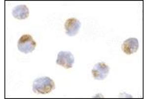 Immunocytochemistry of Mcl-1 in Raji cells with this product at 10 μg/ml. (MCL-1 antibody  (Center))
