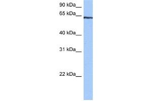 WB Suggested Anti-TTC6 Antibody Titration:  0. (TTC6 antibody  (C-Term))