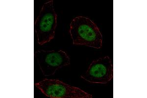 Fluorescent image of  cell stained with MSX1 Antibody (Center) (ABIN1537757 and ABIN2838265). (MSX1 antibody  (AA 111-138))