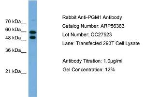 Western Blotting (WB) image for anti-Phosphoglucomutase 1 (PGM1) (Middle Region) antibody (ABIN2786673) (Phosphoglucomutase 1 antibody  (Middle Region))