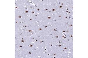 Immunohistochemical staining of human cerebral cortex with PRAMEF12 polyclonal antibody  shows strong nuclear positivity in neuronal cells. (PRAMEF12 antibody)