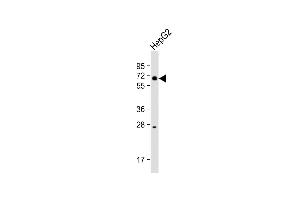 Anti-BTRC Antibody (N-term) at 1:1000 dilution + HepG2 whole cell lysate Lysates/proteins at 20 μg per lane.