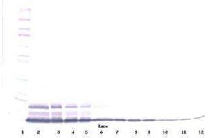 Image no. 2 for anti-Interleukin 8 (IL8) antibody (ABIN465357) (IL-8 antibody)