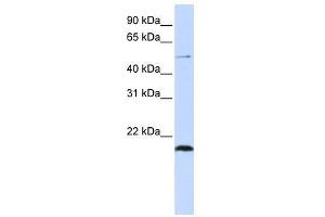 Western Blot showing ZNF683 antibody used at a concentration of 1-2 ug/ml to detect its target protein. (ZNF683 antibody  (N-Term))