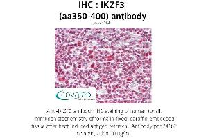 Image no. 1 for anti-IKAROS Family Zinc Finger 3 (Aiolos) (IKZF3) (AA 350-400) antibody (ABIN1735871) (IKZF3 antibody  (AA 350-400))
