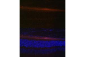 Immunofluorescence analysis of rat retina using RDH5 Polyclonal Antibody (ABIN6130851, ABIN6146839, ABIN6146840 and ABIN6224076) at dilution of 1:100 (40x lens). (RDH5 antibody  (AA 24-318))