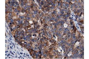 Immunohistochemical staining of paraffin-embedded Human colon tissue using anti-AK5 mouse monoclonal antibody. (Adenylate Kinase 5 antibody)