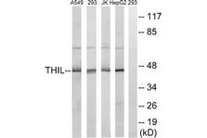 Western blot analysis of extracts from HepG2/Jurkat/293/A549 cells, using ACAT1 Antibody.
