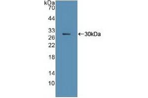Detection of Recombinant Ki67P, Human using Polyclonal Antibody to Ki-67 Protein (Ki-67) (Ki-67 antibody  (AA 3088-3235))