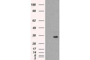 HEK293T cells were transfected with the pCMV6-ENTRY control (Left lane) or pCMV6-ENTRY FAHD2A (Right lane) cDNA for 48 hrs and lysed. (FAHD2A antibody)