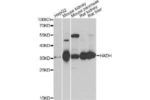 Western blot analysis of extracts of various cell lines, using HADH antibody. (HADH antibody)