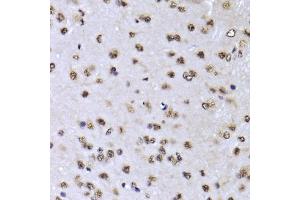 Immunohistochemistry of paraffin-embedded mouse brain using EFTUD2 Antibody (ABIN5974236) at dilution of 1/100 (40x lens). (EFTUD2 antibody)