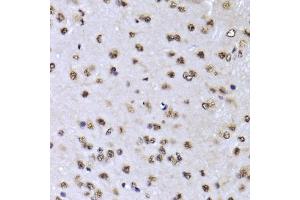 Immunohistochemistry of paraffin-embedded mouse brain using EFTUD2 Antibody (ABIN5974236) at dilution of 1/100 (40x lens).