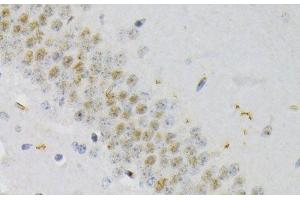 Immunohistochemistry of paraffin-embedded Mouse brain using Phospho-CREB1(S133) Polyclonal Antibody at dilution of 1:200 (40x lens). (CREB1 antibody  (pSer133))