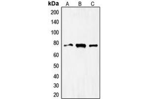 Western blot analysis of FOXO1 expression in HeLa (A), MCF7 (B), Jurkat (C) whole cell lysates. (FOXO1 antibody  (Center))