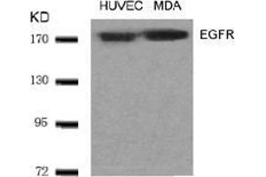 Image no. 1 for anti-Epidermal Growth Factor Receptor (EGFR) (AA 1068-1072) antibody (ABIN197229) (EGFR antibody  (AA 1068-1072))