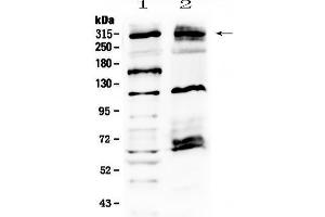 Western blot analysis of MED13 using anti-MED13 antibody .