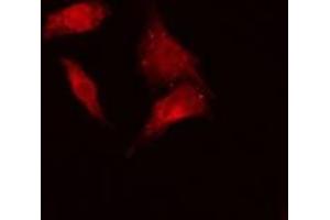 ABIN6279204 staining Hela cells by IF/ICC. (BCCIP antibody  (C-Term))