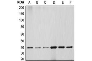 Western blot analysis of HSP40 expression in HEK293T (A), HeLa (B), NIH3T3 (C), PC12 (D), Jurkat (E), HepG2 (F) whole cell lysates.