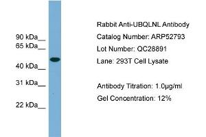 WB Suggested Anti-UBQLNL  Antibody Titration: 0. (UBQLNL antibody  (Middle Region))