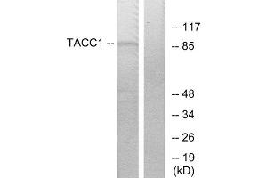 Western Blotting (WB) image for anti-Transforming, Acidic Coiled-Coil Containing Protein 1 (TACC1) (N-Term) antibody (ABIN1849024) (TACC1 antibody  (N-Term))