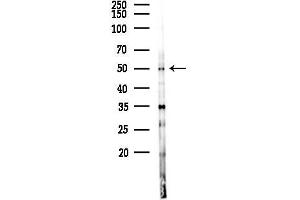 anti-Protein Phosphatase 4, Regulatory Subunit 2 (PPP4R2) (Internal Region) antibody