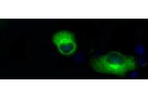 Image no. 3 for anti-Amyloid beta (A4) Precursor Protein (APP) antibody (ABIN1496878) (APP antibody)