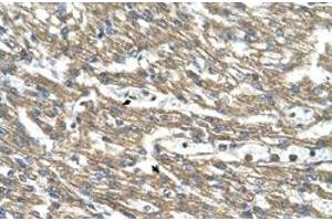 Immunohistochemical staining (Formalin-fixed paraffin-embedded sections) of human heart with CTH polyclonal antibody  at 4-8 ug/mL working concentration.