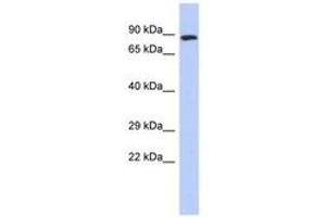 Image no. 1 for anti-Zinc Finger, FYVE Domain Containing 20 (ZFYVE20) (N-Term) antibody (ABIN6742873) (Rabenosyn 5 antibody  (N-Term))