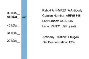 WB Suggested Anti-MRE11A  Antibody Titration: 0. (Mre11 antibody  (Middle Region))