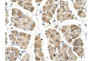 KLHL31 antibody was used for immunohistochemistry at a concentration of 4-8 ug/ml to stain Skeletal muscle cells (arrows) in Human Muscle.